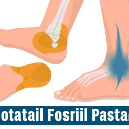 The Science Behind Plantar Fasciitis and Brutal Running